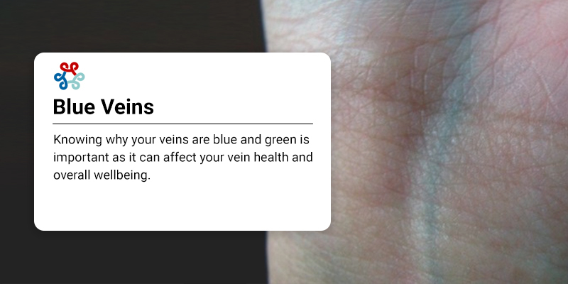 10. "Blue Veins and Hair Color: Common Mistakes to Avoid" - wide 2