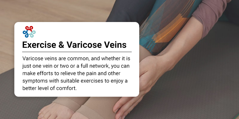 Exercise and Varicose Veins