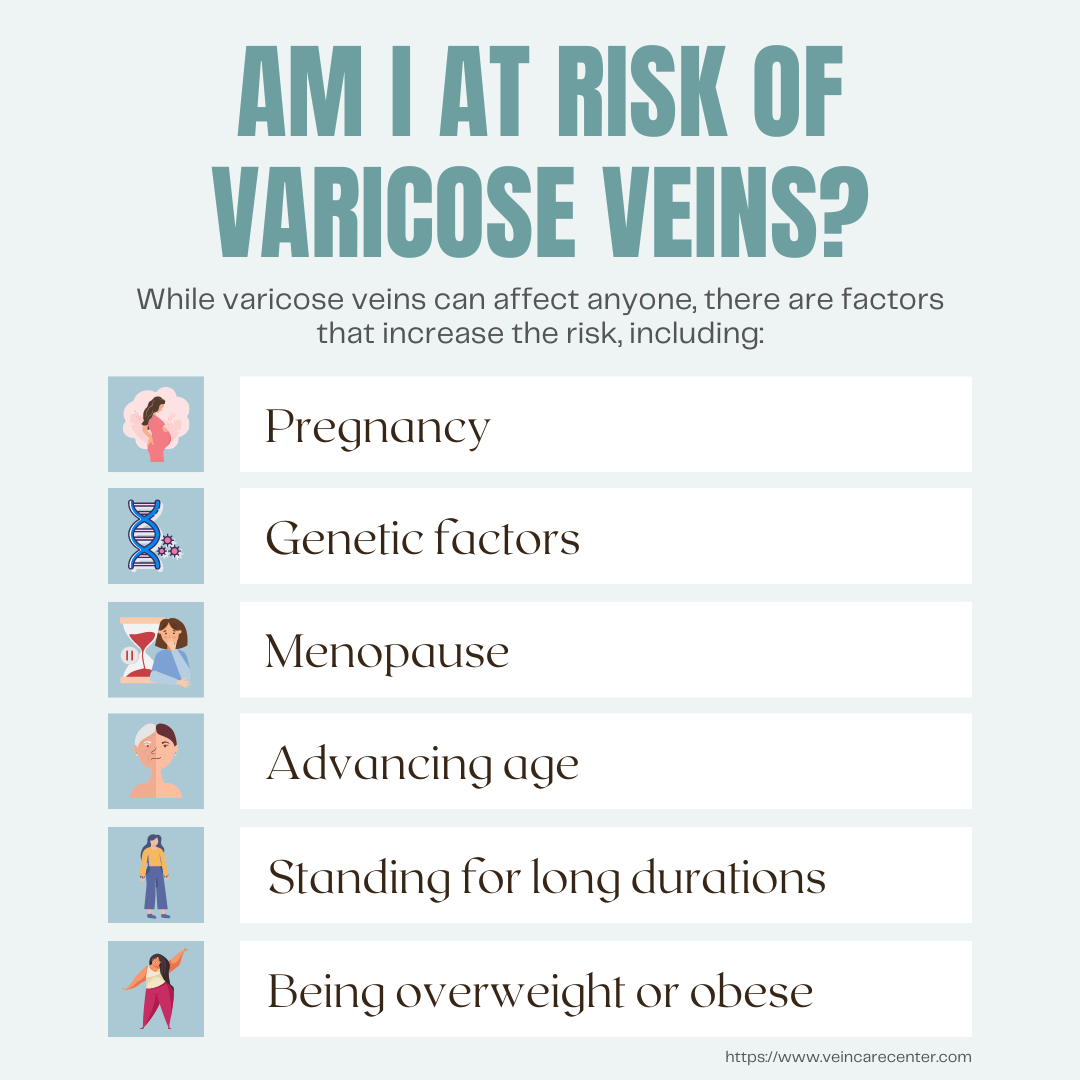 Am I At Risk of Varicose Veins