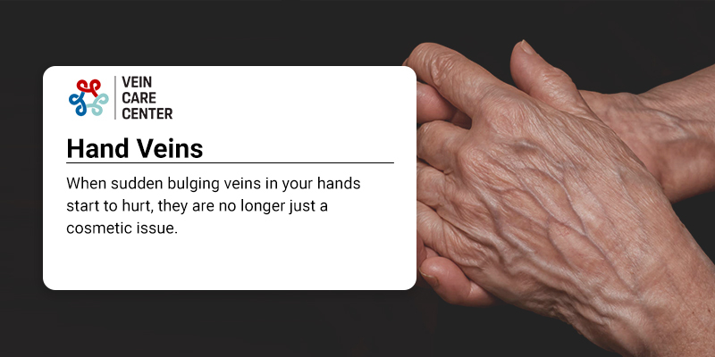 Hand Veins