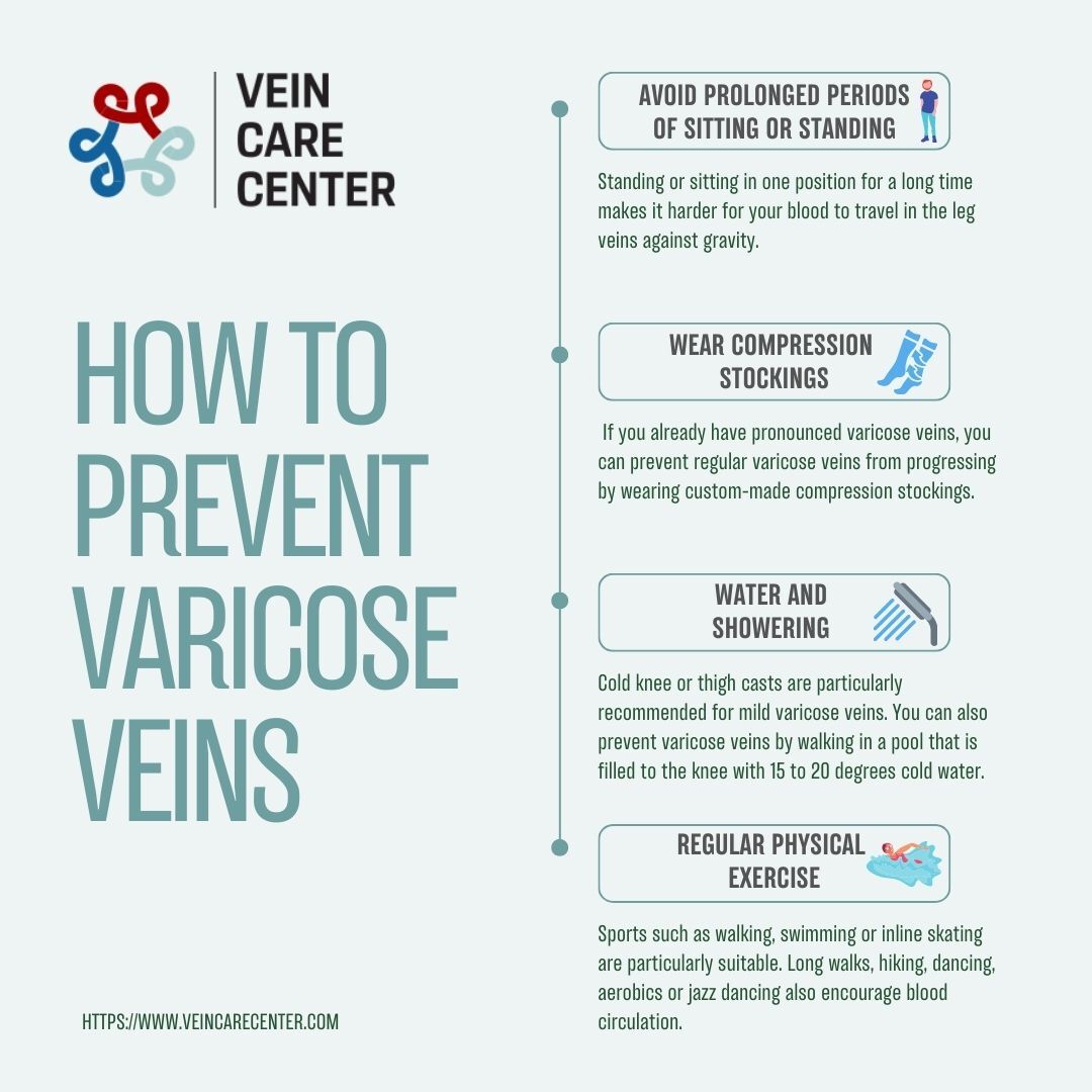 Best leg exercises for varicose veins hotsell
