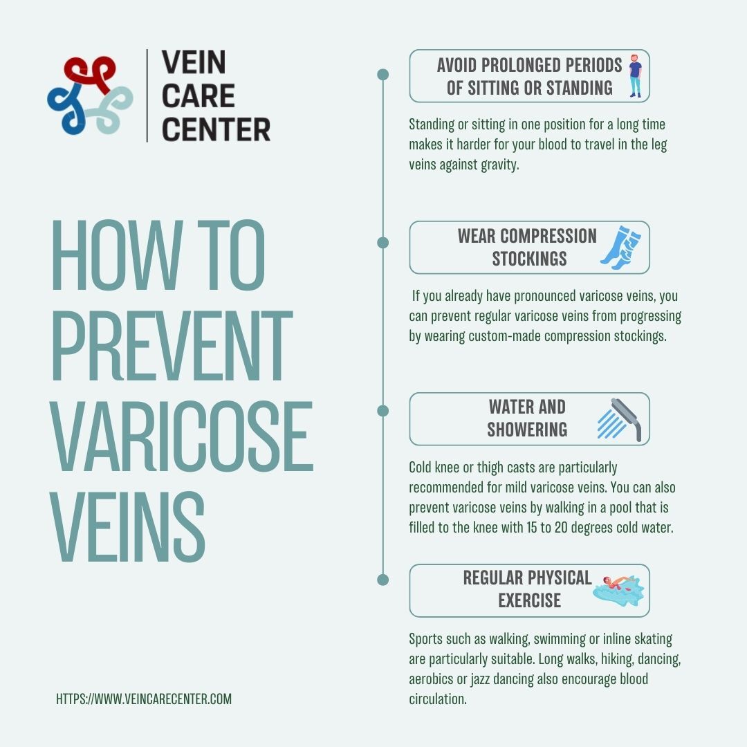 How To Prevent Varicose Veins - Vein Care Center