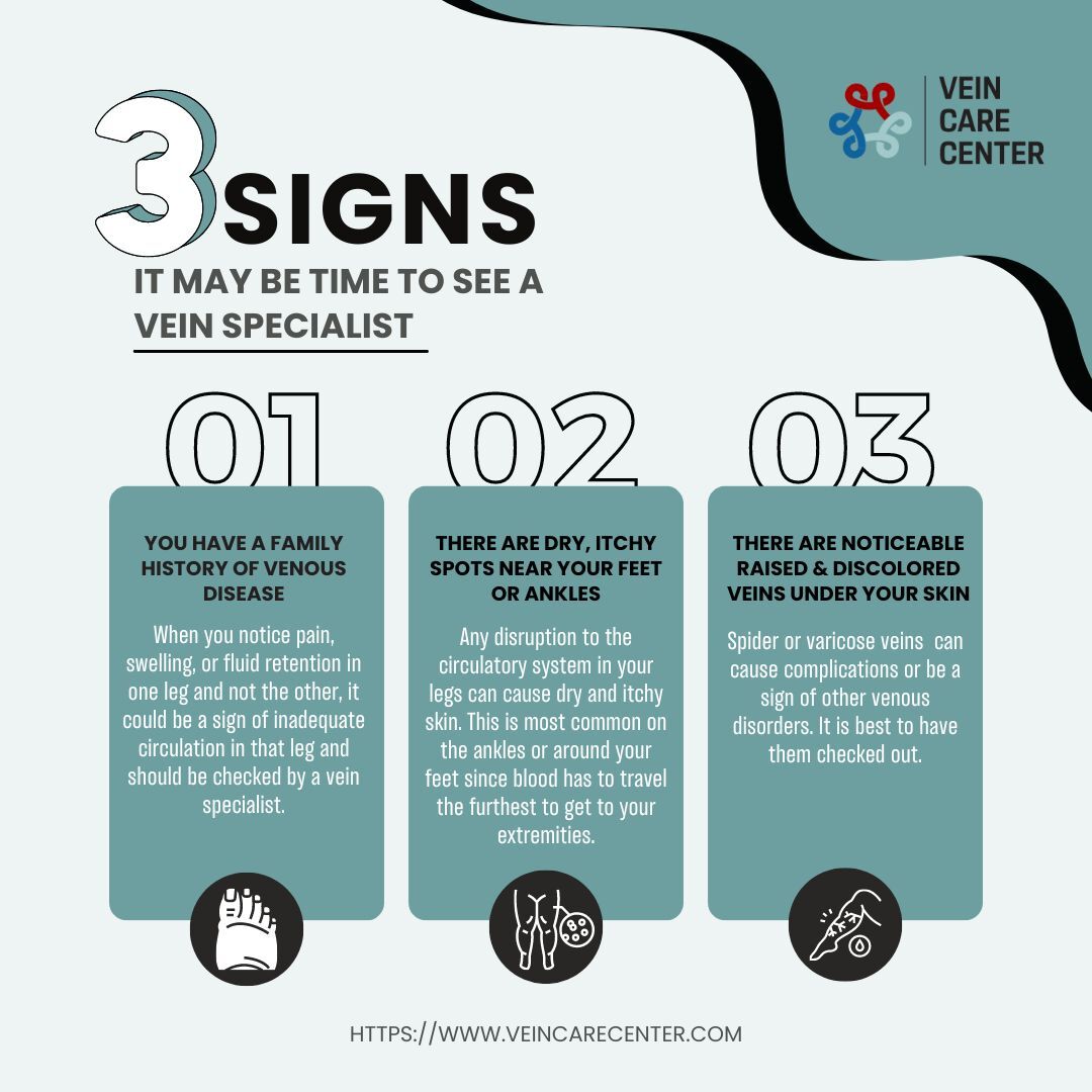 Signs It May Be Time to See a Vein Specialist